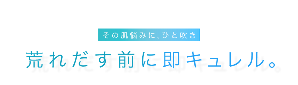 Curel キュレル ディープモイスチャースプレー (60g) 花王 キュレル ディープモイスチャー 化粧水 スプレー 風呂 メイクの上から 敏感肌 頭 顔 男性 肌荒れ 保湿 風呂上がり メイク直し ニキビ 化粧水 ミスト 化粧の上から 化粧直し マスク
